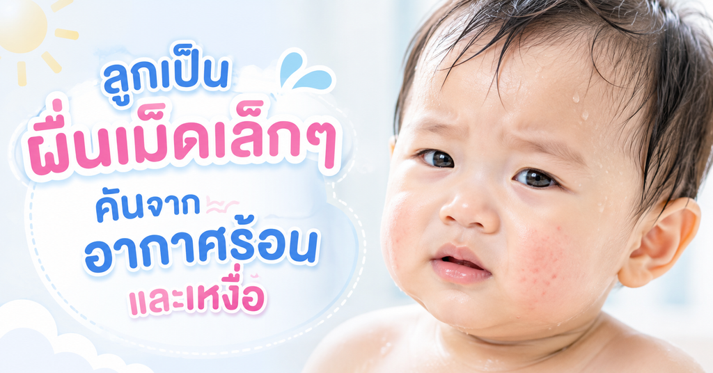 ลูกผื่นขึ้นหน้า เกิดจากอะไร? รู้จักสาเหตุผื่นในเด็กและวิธีดูแลผิวอย่างถูกต้อง 2 ลูกเป็นผื่นเม็ดเล็กๆ จากอากาศร้อนและเหงือ